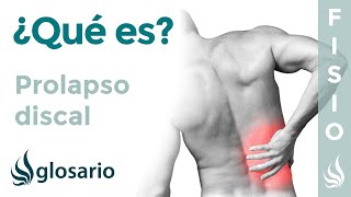 PROLAPSO DISCAL  Qué es qué estructuras afecta síntomas causas y tratamiento fisioterapéutico [upl. by Ainesej136]