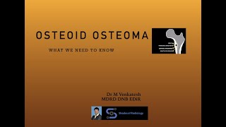 Osteoid OsteomaWhat we need to know [upl. by Selij]