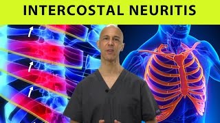 Intercostal Neuritis Relief Mid Back Pain Rib amp Chest Pain  Dr Mandell [upl. by Dirk]