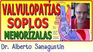 Memoriza las VALVULOPATÍAS y SOPLOS ✅ rápido y fácil [upl. by Jolene]