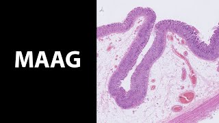 Maag wat een fraai epitheel De histologiemicroscopie van de maag [upl. by Alleon27]