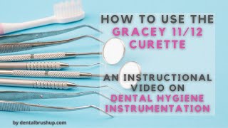 How to use the Gracey 1112 Curette [upl. by Ytima356]