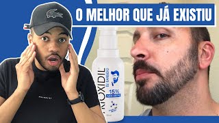 Trioxidil 15 Minoxidil funciona mesmo Trioxidil 15 Cresce a Barba Mesmo  O MELHOR MINOXIDIL [upl. by Amr234]