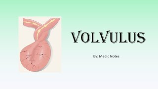 Volvulus  risk factors clinical features investigation treatment complication [upl. by Harihat]