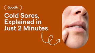 What Is a Cold Sores Heres a TwoMinute Explanation  GoodRx [upl. by Sapienza55]