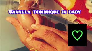 How to Cannulate an Infant Pediatric Cannulation Techniques [upl. by Dorwin]