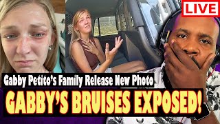 BREAKING Newly Released Photo From Gabby Petitos Phone Shows Bruises Before Moab Traffic Stop [upl. by Follmer]