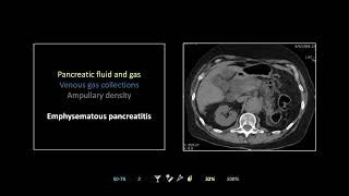 Thoracoabdominal Emergencies V  Free Radiology CME [upl. by Phylis748]