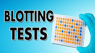 Blotting Techniques Western Blot Southern Blot and Northern Blot [upl. by Atilef]