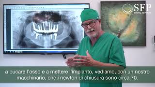 Come funziona un intervento a carico immediato  SFP Dental Service [upl. by Sauer]