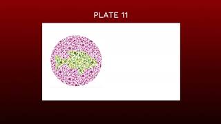 TEST YOURSELF  COLOR BLIND CHILD TEST [upl. by Mariette296]