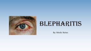 Staphylococcal and seborrhoeic blepharitis treatment of eyelid inflammation [upl. by Aneel]