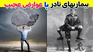 بیماریهای نادری که به انسان تواناییهای ابرقهرمانی میدن [upl. by Cummins361]