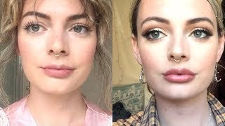 05ML LIP FILLERS  BEFORE AND AFTER  ONE WEEK VLOG 💉 [upl. by Sherill]