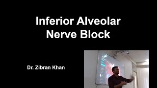 Inferior Alveolar Nerve Block [upl. by Aerdnaek]