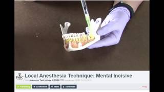 Local Anesthesia Technique  Mental Incisive [upl. by Gad]