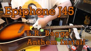 Epiphone J45 Gets LR Baggs Anthem EP406 [upl. by Analat]