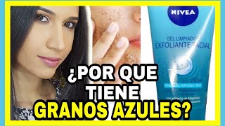 COMO se usa el EXFOLIANTE para la cara gel limpiador de NIVEA para PIEL GRASA acne  SKINCARE [upl. by Nedrah]