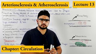 Arteriosclerosis amp Atherosclerosis CardioVascularDisorder  Chapter circulation Video  13 [upl. by Soigroeg]