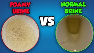 Foamy Urine vs Normal Urine What’s the Difference [upl. by Crawford44]