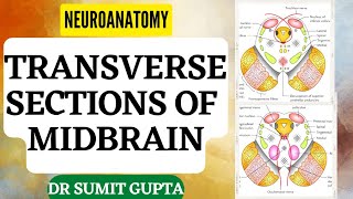 Transverse Sections of Midbrain  NEUROANATOMYTHE BRAINSTEM [upl. by Shoshana766]