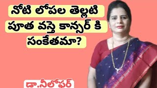 Leukoplakia Telugu Oral Cancer Precancerous Lesions Leukoplakia Symptoms Leukoplakia Causes [upl. by Ezaria]