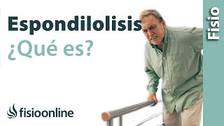 Espondilolisis  ¿Qué es [upl. by Dagney721]