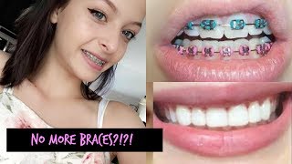 Getting My Braces Off Vlog [upl. by Jason]