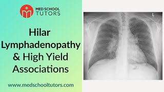 CXRs Hilar Lymphadenopathy and High Yield Associations for the USMLE [upl. by Hoeg]