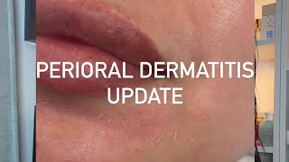 Morning Skincare  Perioral Dermatitis Update [upl. by Adnof]