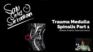 Trauma Medulla Spinalis Part 1  Anterior amp Posterior Cord Syndrome Transverse Lesion [upl. by Zile]