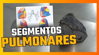 SEGMENTAÇÃO BRONCOPULMONAR identificação em peça natural dos segmentos brônquicos e pulmonares [upl. by Garlanda]