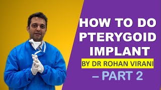 HOW TO DO PTERYGOID IMPLANT BY DR ROHAN VIRANI – PART 2 [upl. by Cinemod]