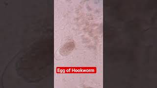 Egg of Hookworm in Stool Microscopy [upl. by Esilehs]