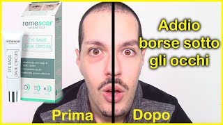 REMESCAR  Provo la crema che toglie le borse sotto gli occhi in 2 minuti Epic fail [upl. by Aihsened]