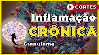 Inflamação Crônica  Patologia Geral [upl. by Os]