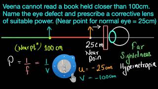 Numerical on hypermetropia Hindi  Human eye and the colourful world  Physics  Khan Academy [upl. by Lleinad]