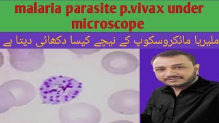 malaria under microscope plasmodium vivax under microscope [upl. by Onairotciv]