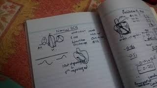 ELECTROCARDIOGRAM all features ch 11 guyton fast review with all important questions part 1 [upl. by Boothman]