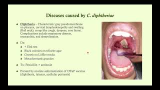 Corynebacterium diphtheriae Diphtheria  Microbiology Boot Camp [upl. by Wain859]