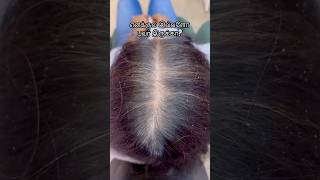 Vitamin D  Essential for hair follicle growth hairbykaleem yafamehandistudio shortstamil [upl. by Andriette154]