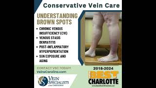 Understanding and Treating Brown Spots on Legs [upl. by Yelmene435]