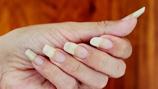 COMO FAZER SUAS UNHAS CRESCEREM MUITO EM POUCOS DIAS [upl. by Evot2]