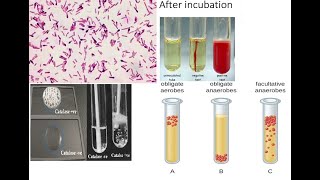 Clostridium botulinum Part 1 Biochemical Properties types of botulism and production of toxin [upl. by Bushey391]