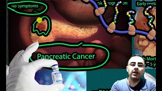 Vaccine for Pancreatic Cancer Treatment Show Promise [upl. by Eno]