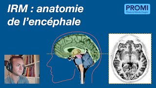 IRM  anatomie de lencéphale [upl. by Yanej250]