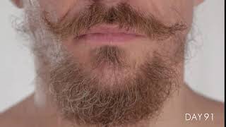 Facial Hair growing for 100 Days in TimeLapse [upl. by Efi]