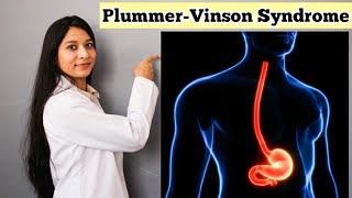 PlummerVinson Syndrome in Hindi  Detail Explanation With Notes  Causes Symptoms Treatment [upl. by Eintroc]