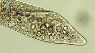 Paramecium caudatum [upl. by Bensen]