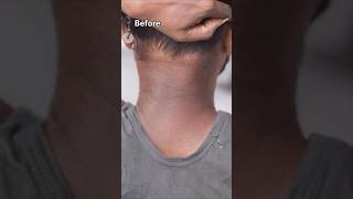 Remove neck darkness easily at homeviralvideo neck short [upl. by Denoting]